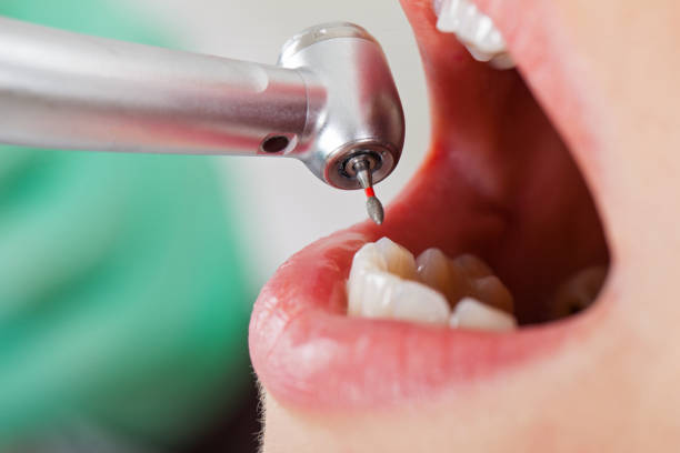 Best Emergency Denture Repair in Marion, IL
